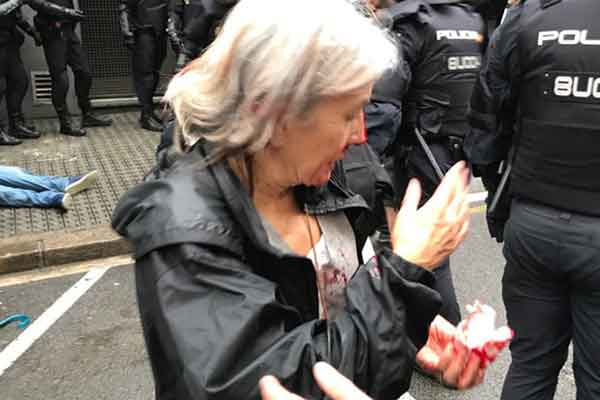 Σοκ στην Καταλονία: Η αστυνομία χτυπά στο «ψαχνό» τους ψηφοφόρους