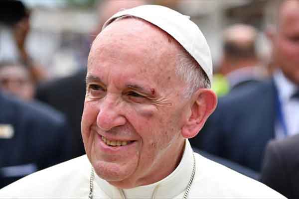 Τραυματίστηκε στο κεφάλι και στο μάτι ο Πάπας Φραγκίσκος -Έπεσε και χτύπησε