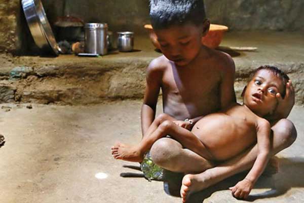 ΟΗΕ: Υποσιτισμένα πέντε στα έξι βρέφη στις αναπτυσσόμενες χώρες