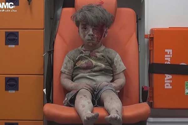 Μια εικόνα χίλιες λέξεις: 5χρονος μετά από αεροπορική επιδρομή στη Συρία