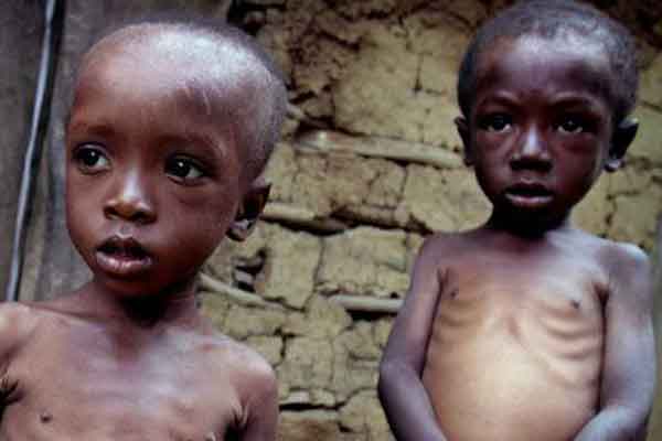 UNICEF: Κάθε μέρα πεθαίνουν 15.000 παιδιά κάτω των 5 ετών