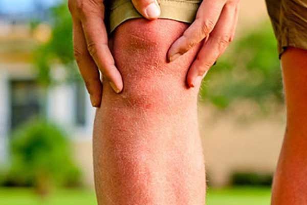 Αρθροπλαστική ισχίου & γόνατος: Είναι απαραίτητο το αδυνάτισμα προεγχειρητικά;