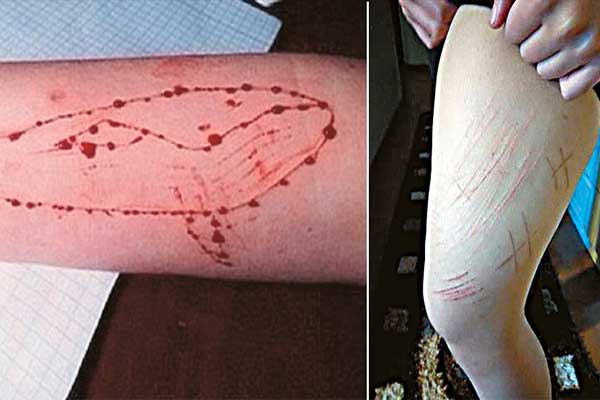 «Mπλε Φάλαινα», «Choking game», «Νεράιδες της φωτιάς» διψούν για εφηβικό αίμα