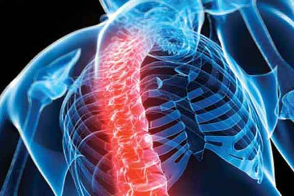 Χιλιάδες ηλικιωμένους σκοτώνει κάθε χρόνο η οστεοπόρωση