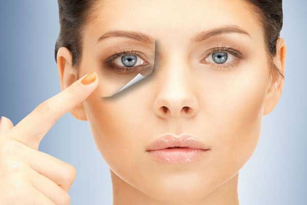 Οι σύγχρονες θεραπείες για τα βαθουλωμένα μάτια και τις “σακούλες”