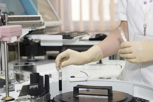 Γερμανία: Ατομικά τεστ αυτοδιάγνωσης του ιού HIV από τα φαρμακεία